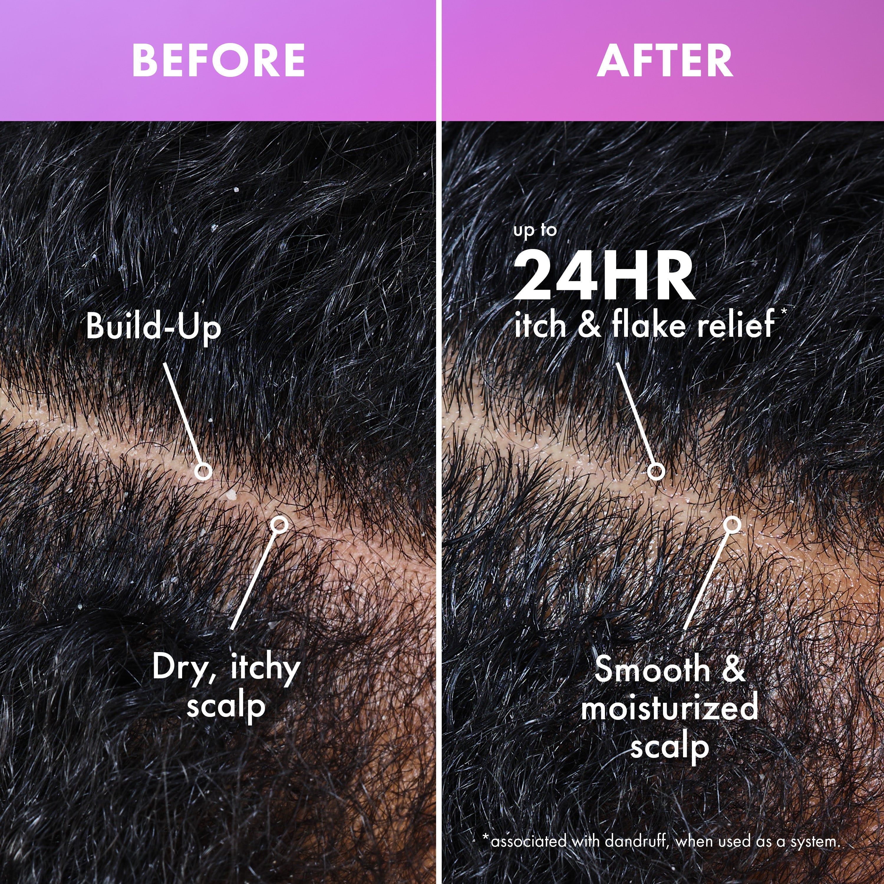 Lavender & Lychee Scalp Soothing Daily Refresher